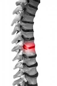 Spinal Cord Injuries and Their Effects on the Body