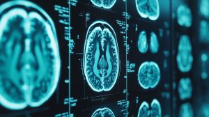 Neurological Disorders After an Injury